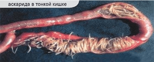 аскаридоз у куриц аскаридоз у куриц